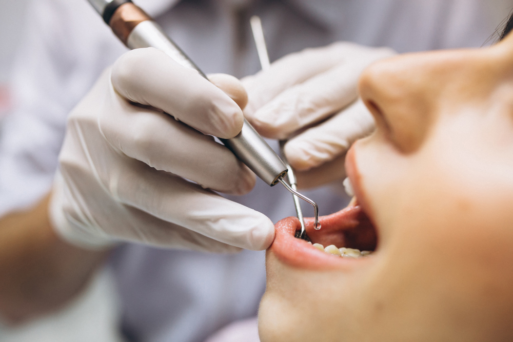 ניתוח הרמת סינוס סגורה במרפאת One Dental