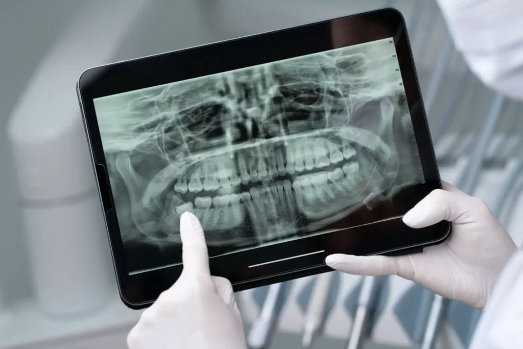 צילומי CT במרפאת One Dental