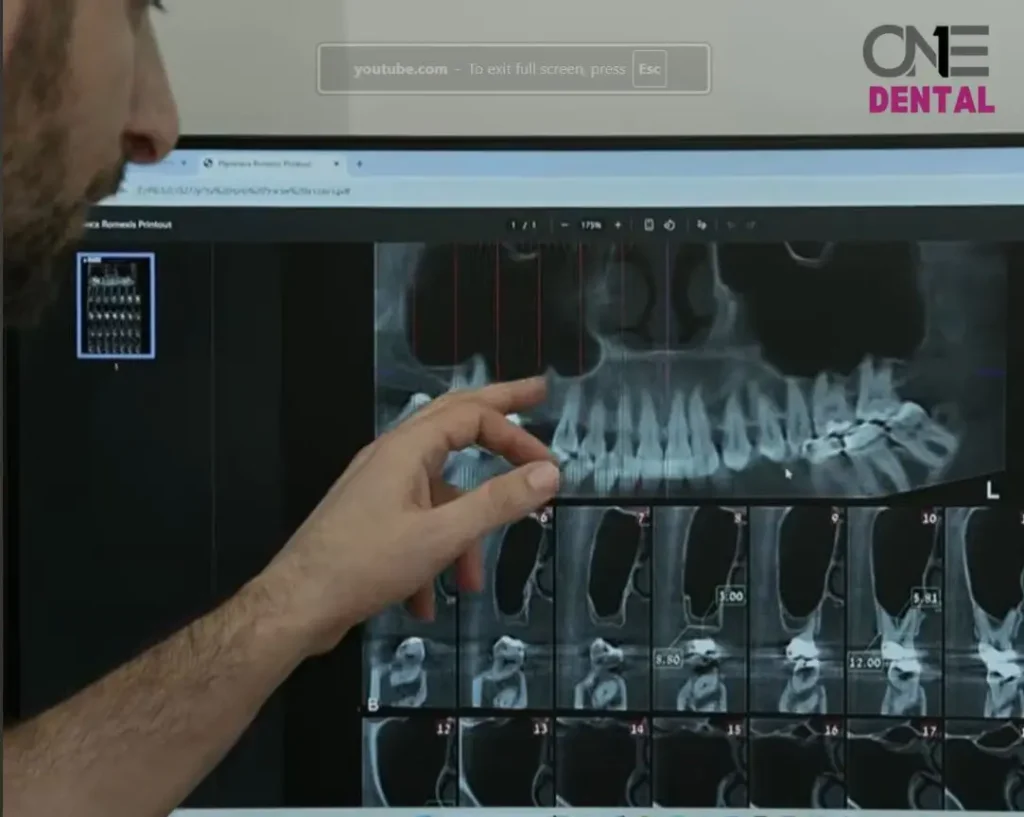 הצגה של הדמיית שיניים במרפאת One Dental